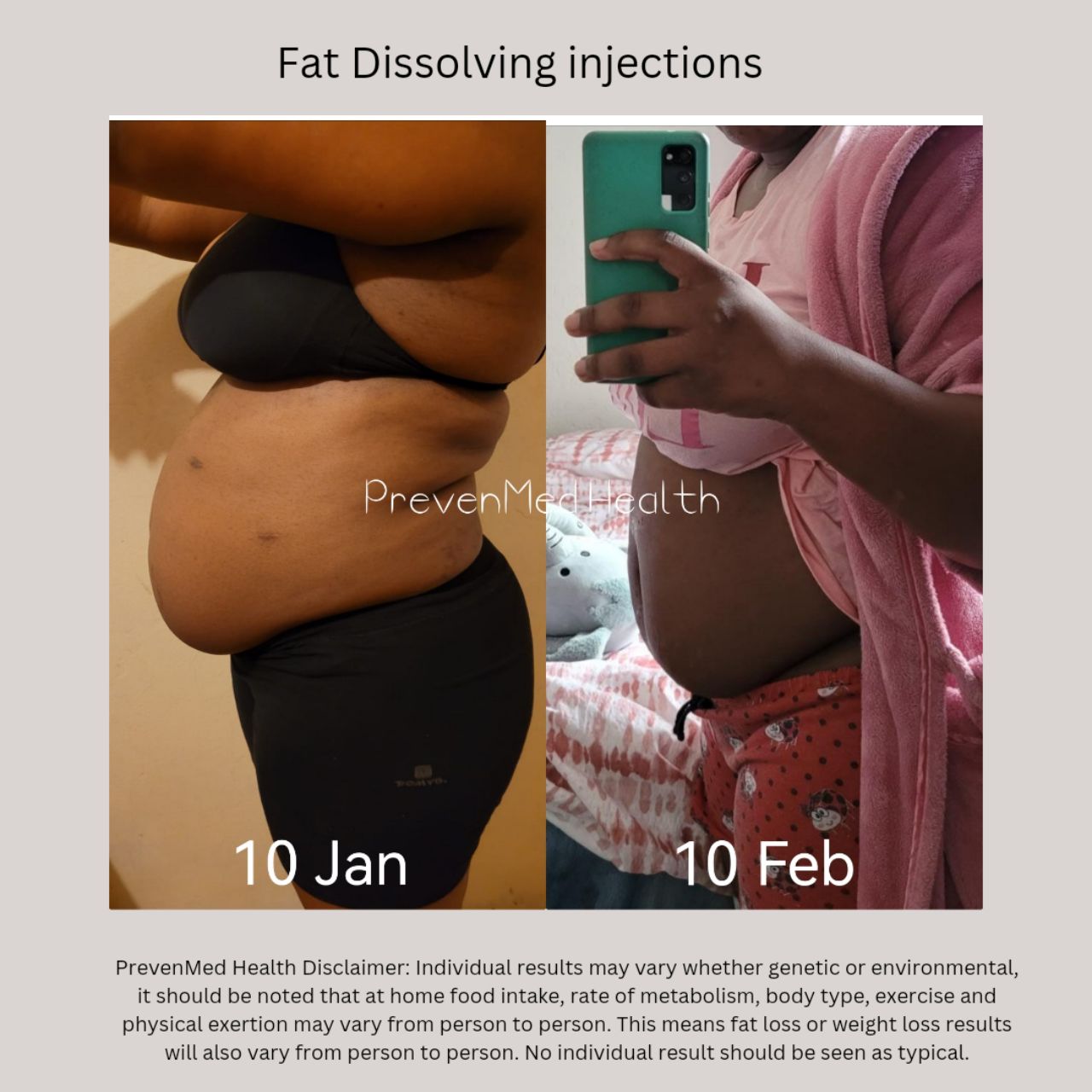 Fat Dissolving Therapy