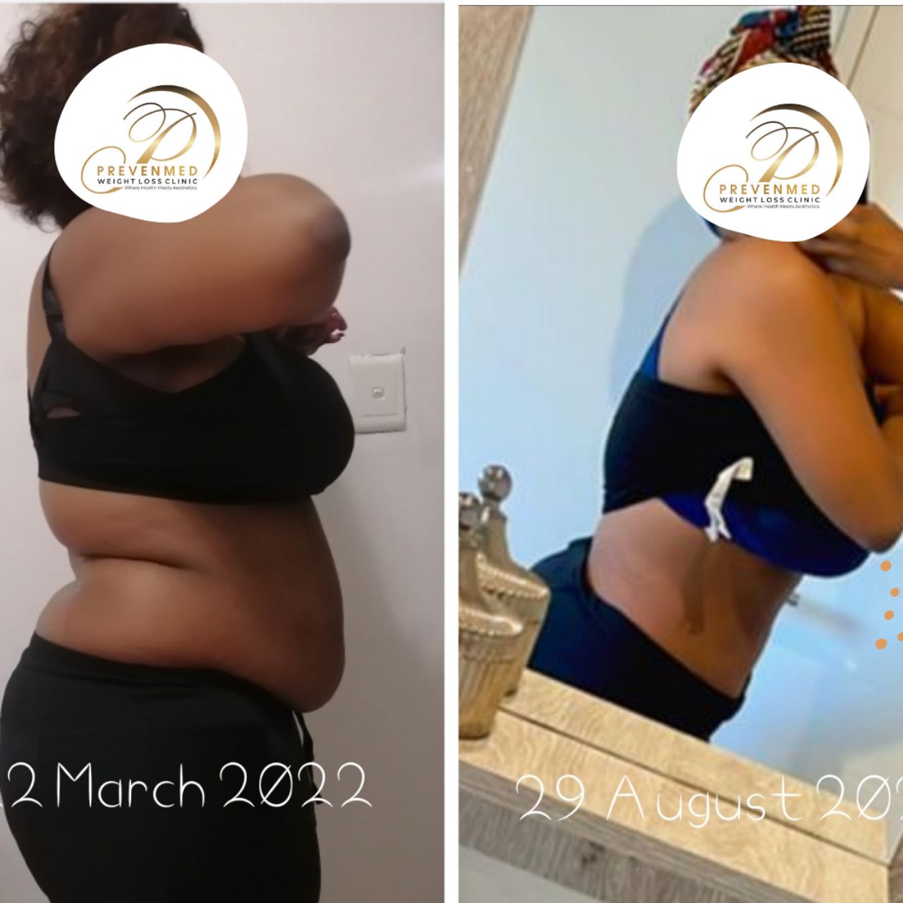 Snatch Drip + Fat Dissolving injection